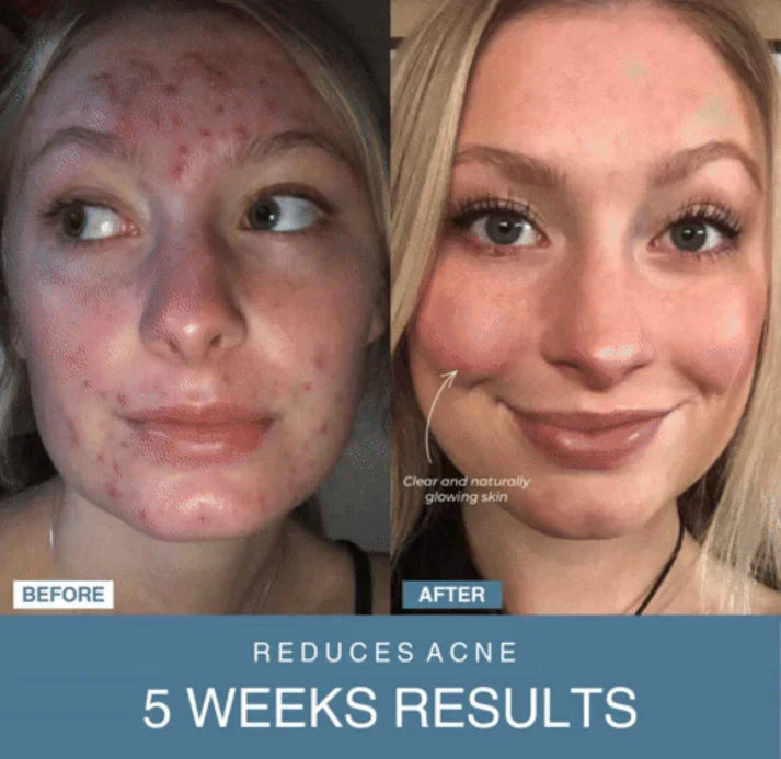 Shop Shuffle 7-in-1 LED Anti-Aging/Wrinkle Apparatus