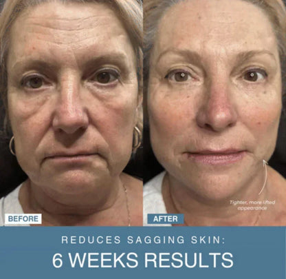 Shop Shuffle 7-in-1 LED Anti-Aging/Wrinkle Apparatus