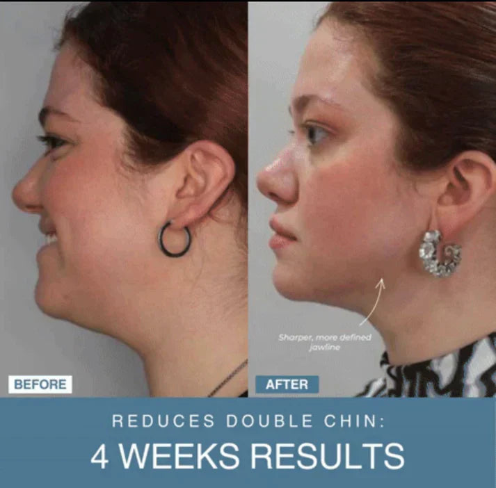 Shop Shuffle 7-in-1 LED Anti-Aging/Wrinkle Apparatus