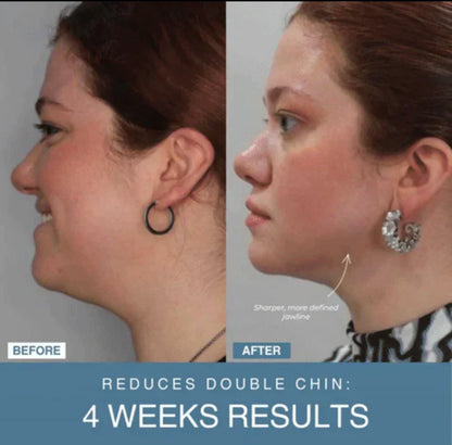 Shop Shuffle 7-in-1 LED Anti-Aging/Wrinkle Apparatus